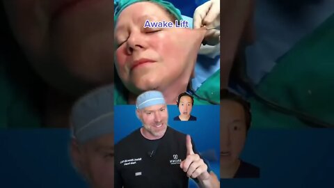 Awake During a Face Lift?! 😱 #shorts