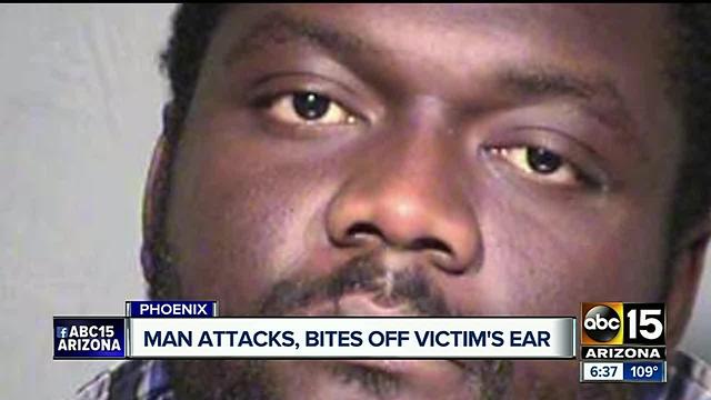 Man attacks wheelchair-bound man, bites ear off