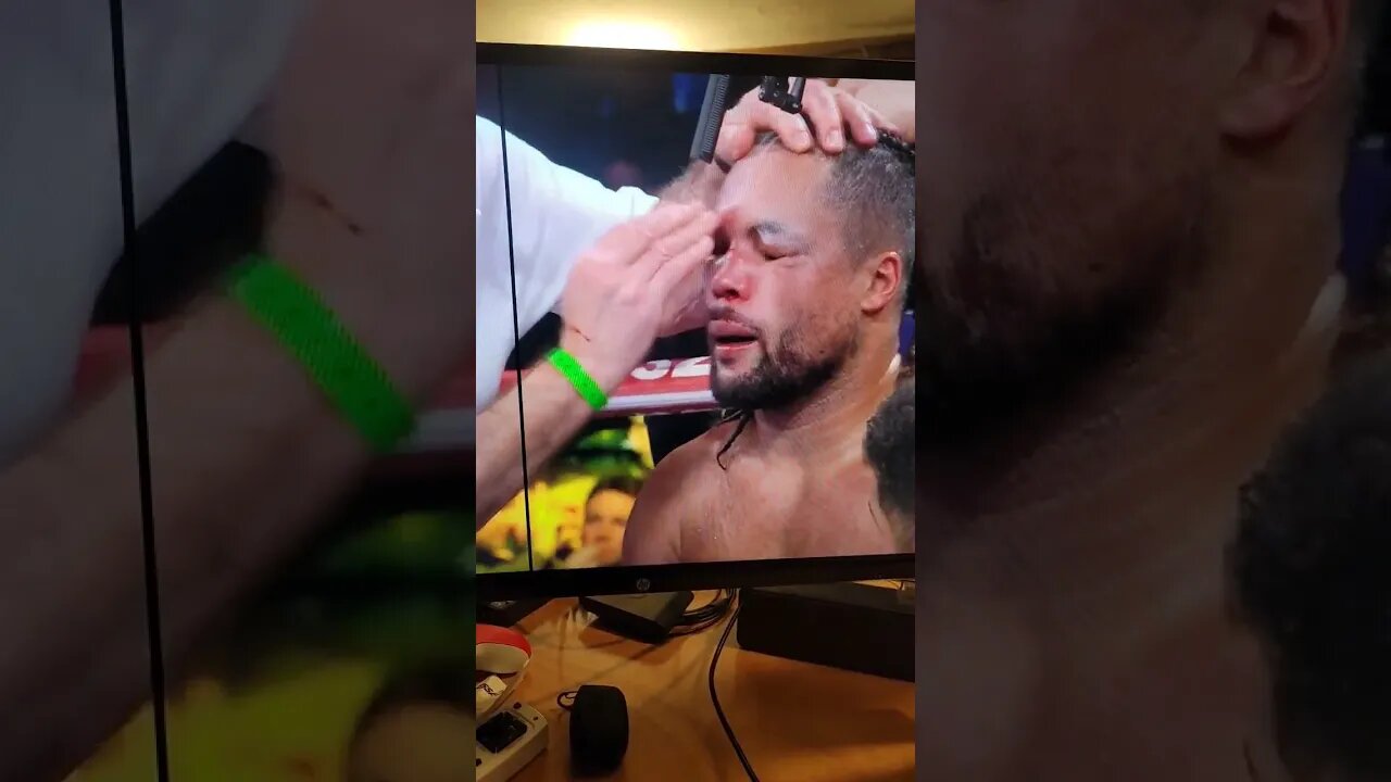 Joe Joyce getting treated by Zhilei Zhang