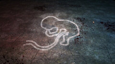 Next Up On The Docket - A New Bill Calling Forth Beheadings, Dismemberments, And Saline Injections