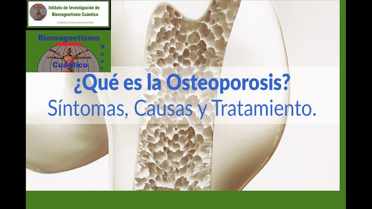 Tratamiento Integral de la Osteoporosis: Biodescodificación y Biomagnetismo