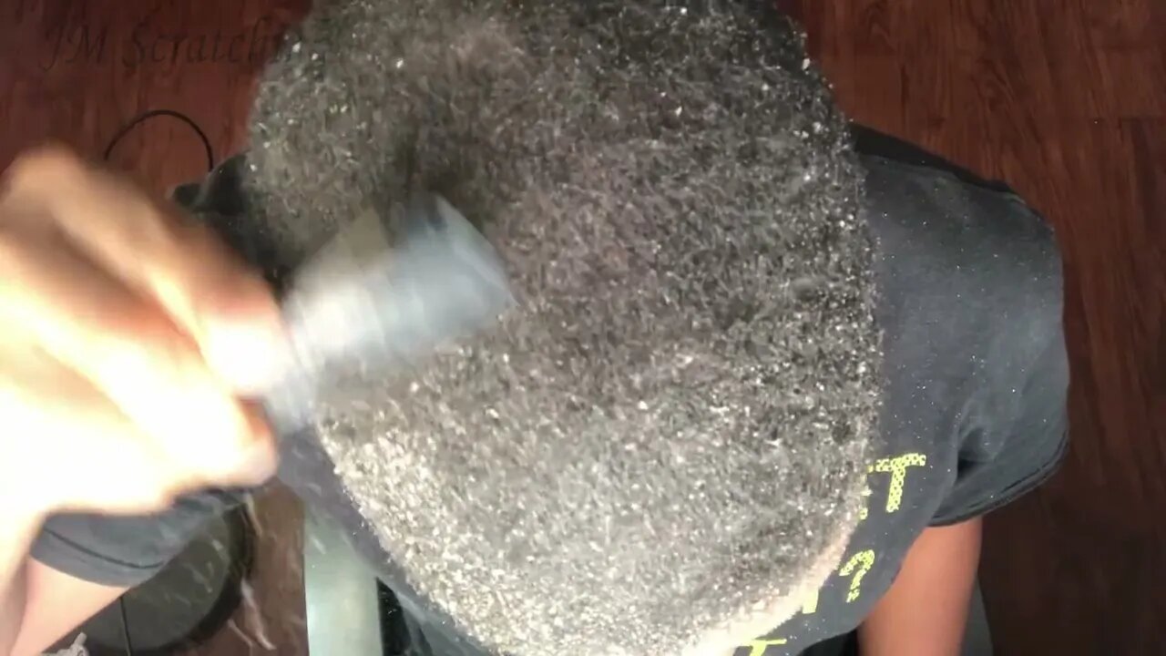 Satisfying Dandruff Scratching