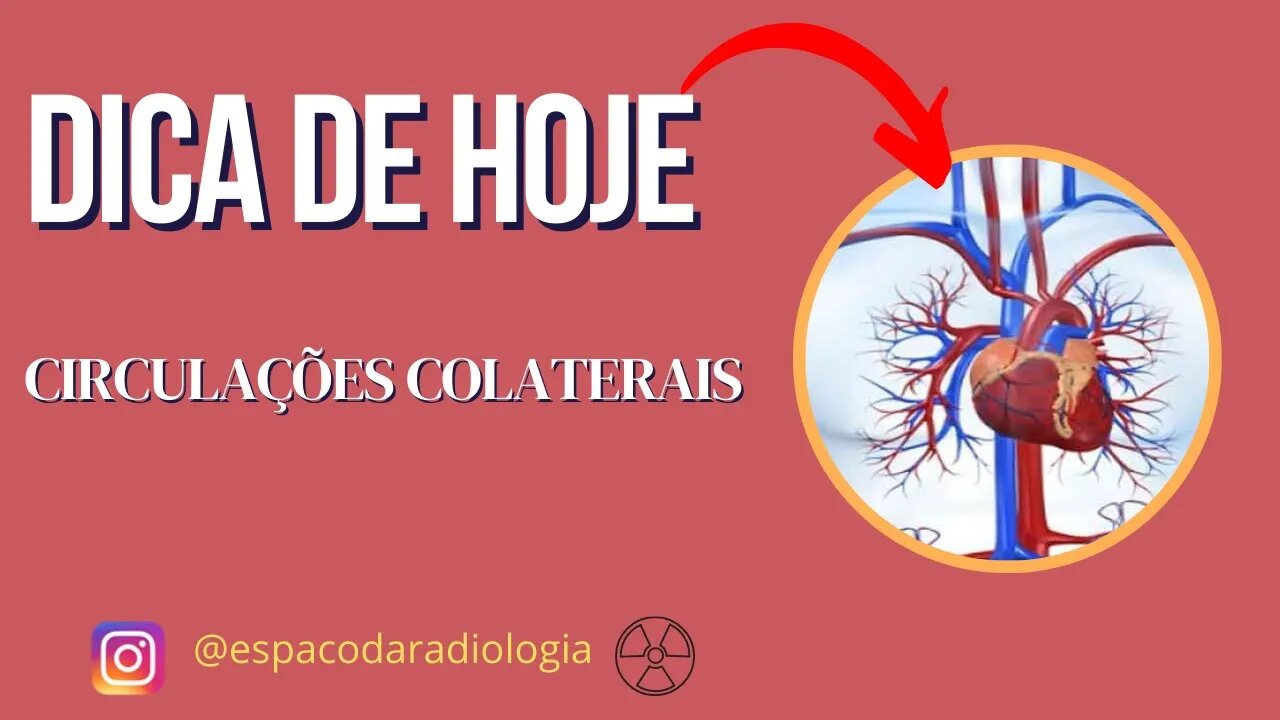 [CIRCULAÇÃO]: Angiotomografia com circulação colateral.