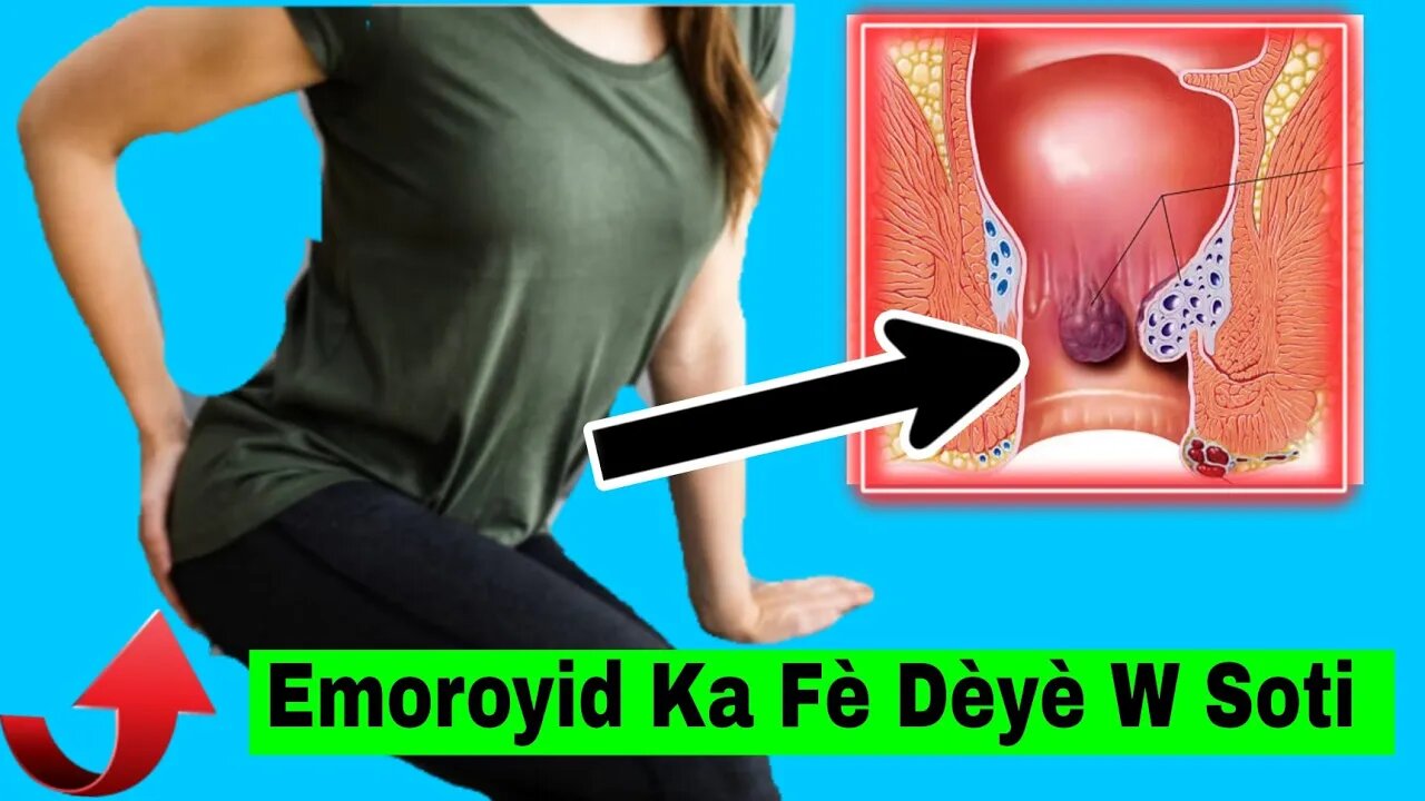 Maladi Sa ka Fè Dèyè W Soti Li Gen Anpil Doulè (hémorroïdes) Se Mèt Ko Ki Veyé ko