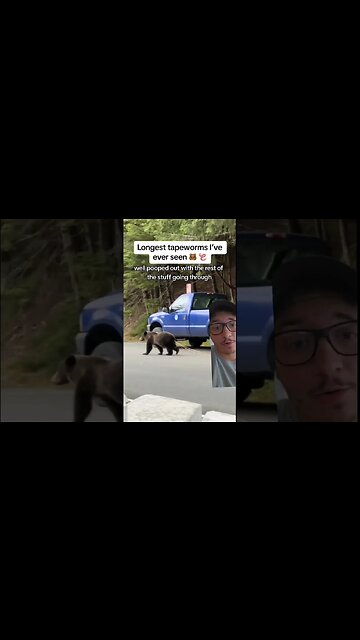 Tapeworms... gross