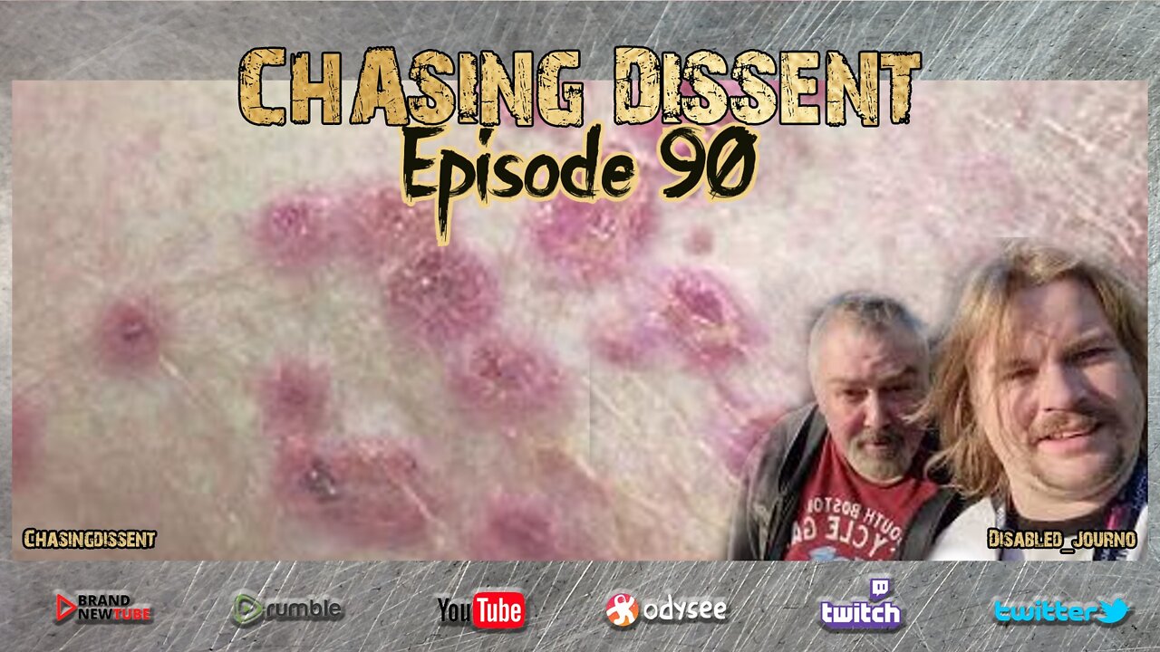 Monkey Pox - Be Afraid? Chasing Dissent LIVE Episode 90