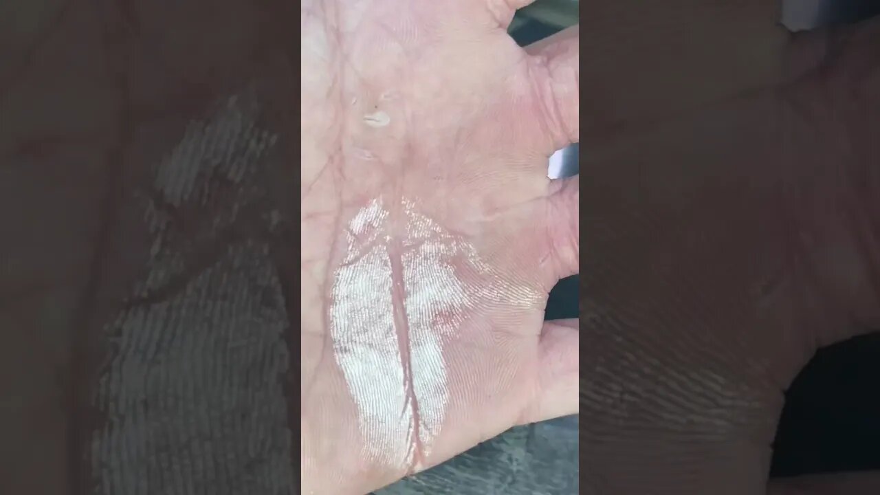 50% peroxide on the hand…..2/2