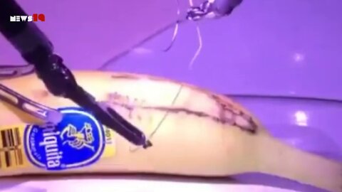 5G - Demonstration of remote surgery using bananas between London and California