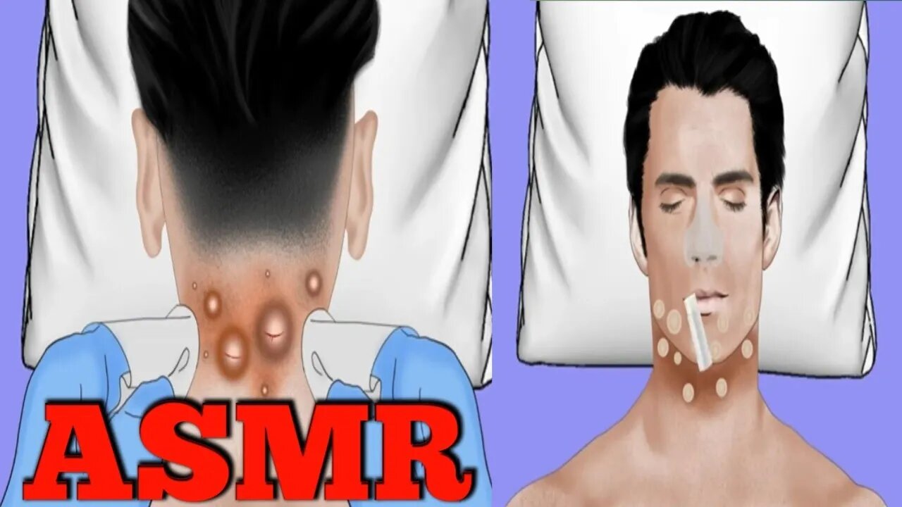 Asm maggots in man's back head//Animations//clean darkspots in man's face//@uttam6361