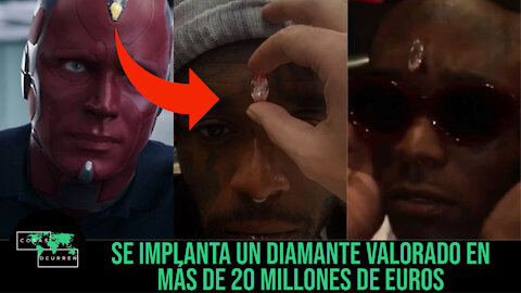 Lil Uzi Vert se implanta en la frente un diamante valorado en más de 20 millones de euros