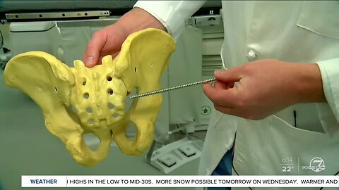 Two Colorado doctors come up with novel procedure to fix pelvic bones weakened by radiation