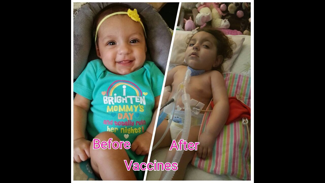 VACCINES ARE KILLING CHILDREN WORLD WIDE !!!