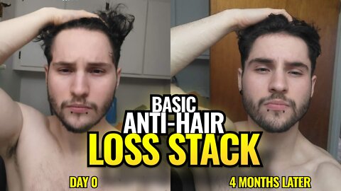 Smart Anti-Hair Loss Protocol BEFORE & AFTER Results