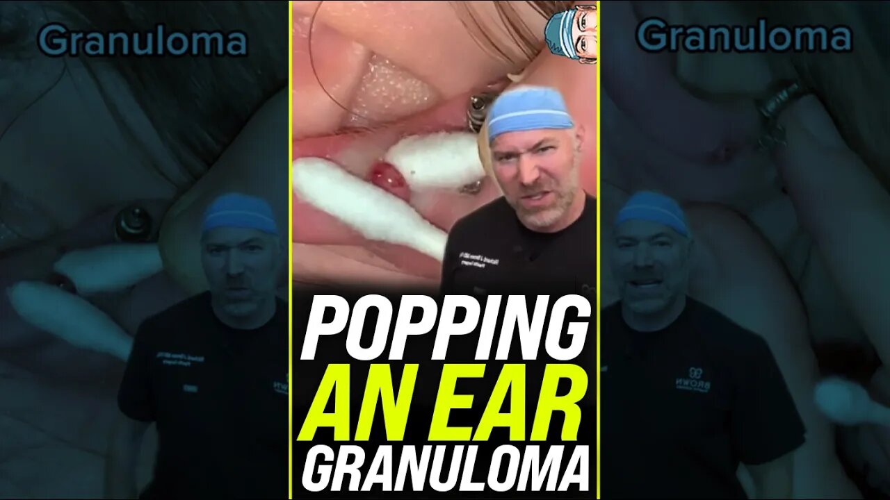 Popping an Ear Granuloma 😱 #shorts