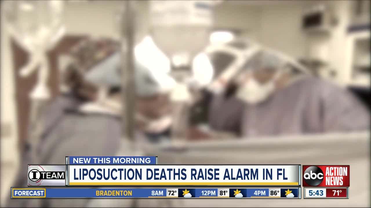 Liposuction in Florida poses serious risks, Medical Board warns