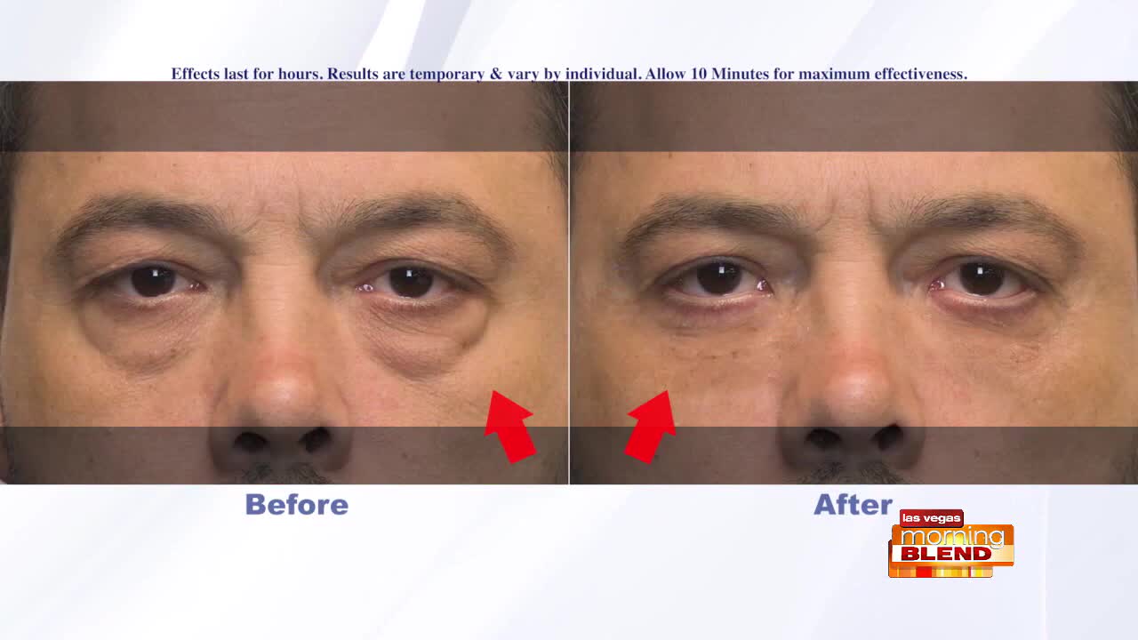 Look Younger For The New Year