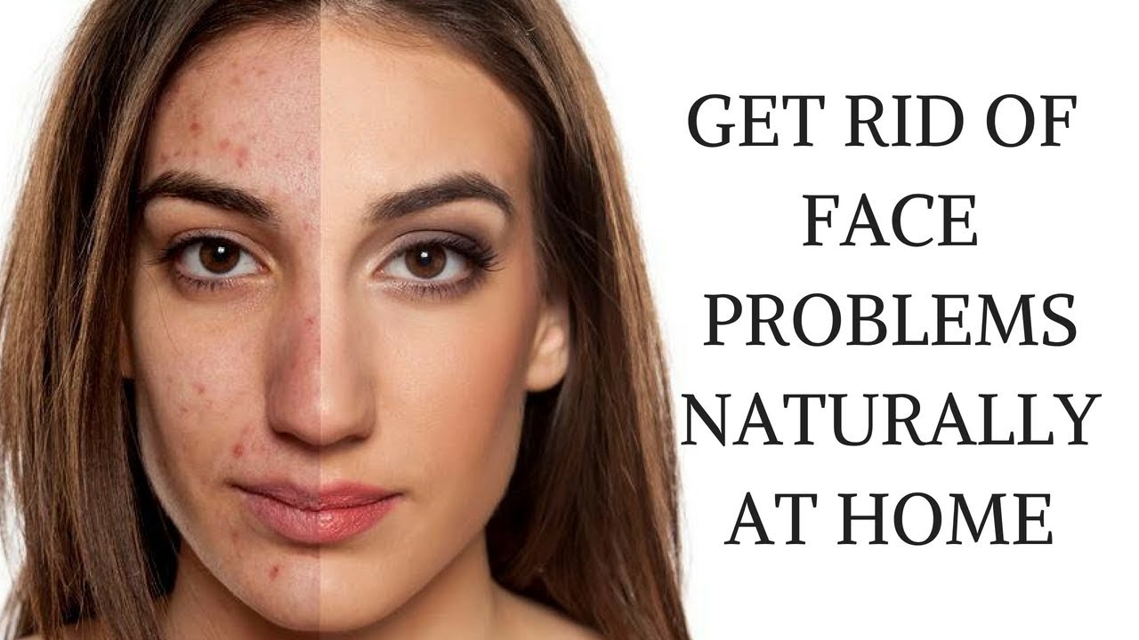 TOP 6 DIY ACNE FIGHTING FACE MASKS - HOW TO GET GLOWY FACE NATURALLY