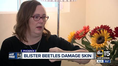 Valley woman hospitalized after encounter with what's known as blister beetles