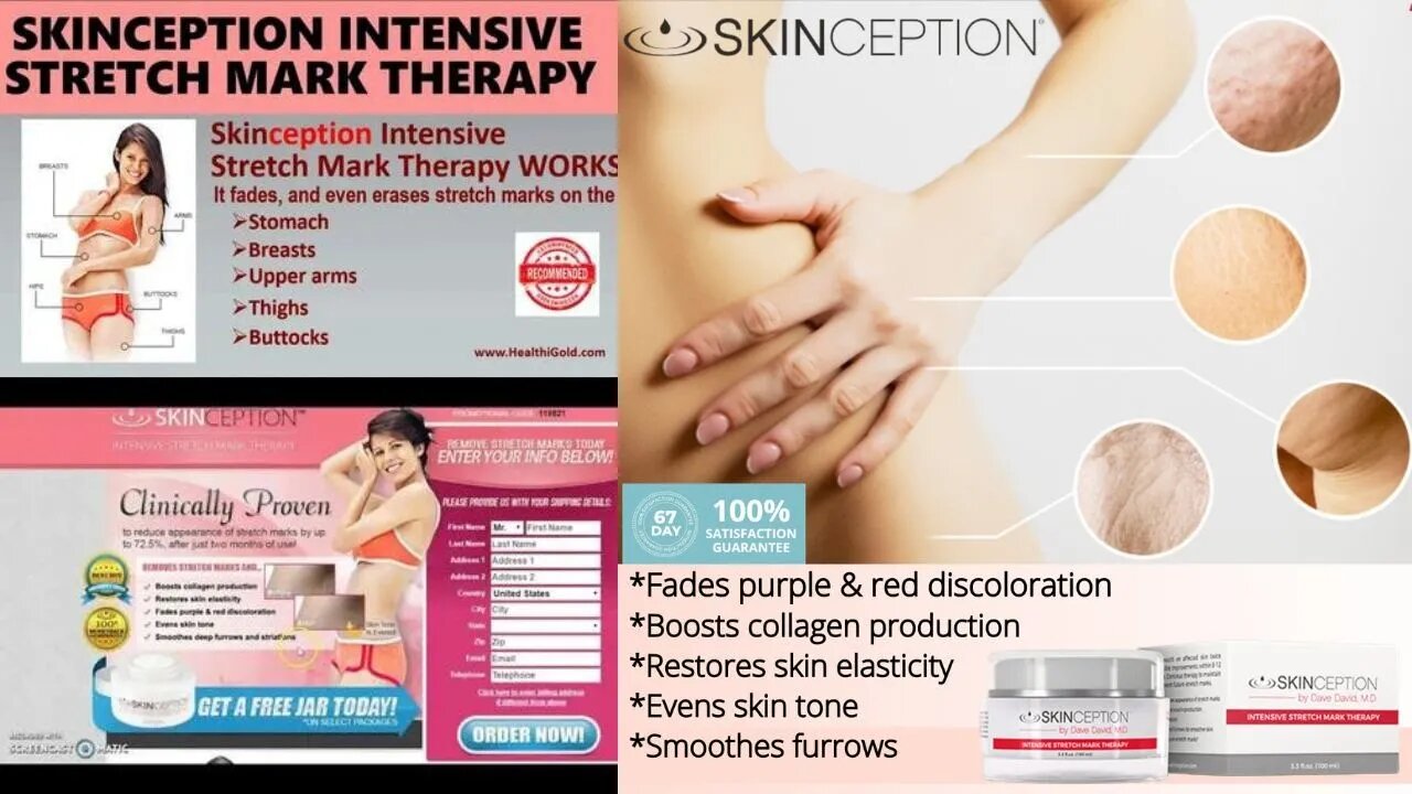 Skinception Intensive Stretch Mark Therapy - Intensive Care of Stretch Marks Skinception #skincare