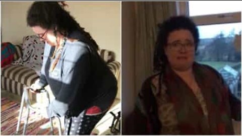 ２年間の車いす生活の後、自分の足で立った女性