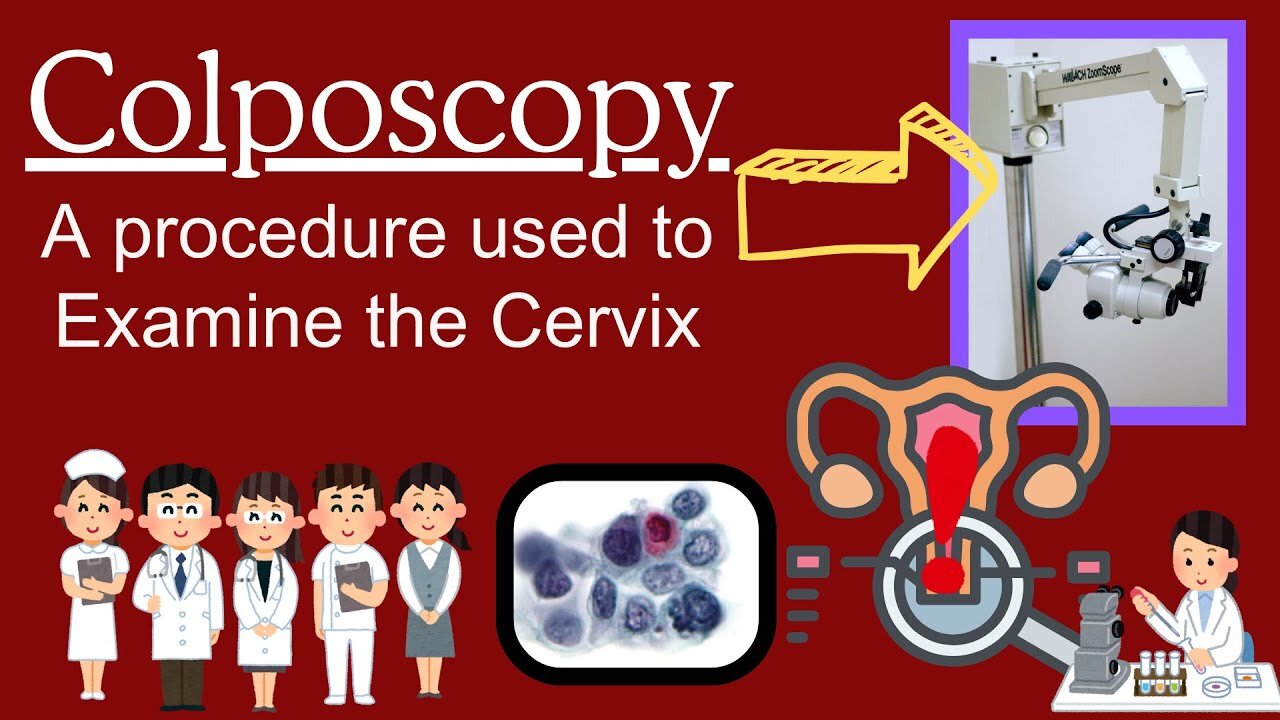 What is Colposcopy? Explained for cervical screening and Cervical Biopsy FOR Cancers and HPVs