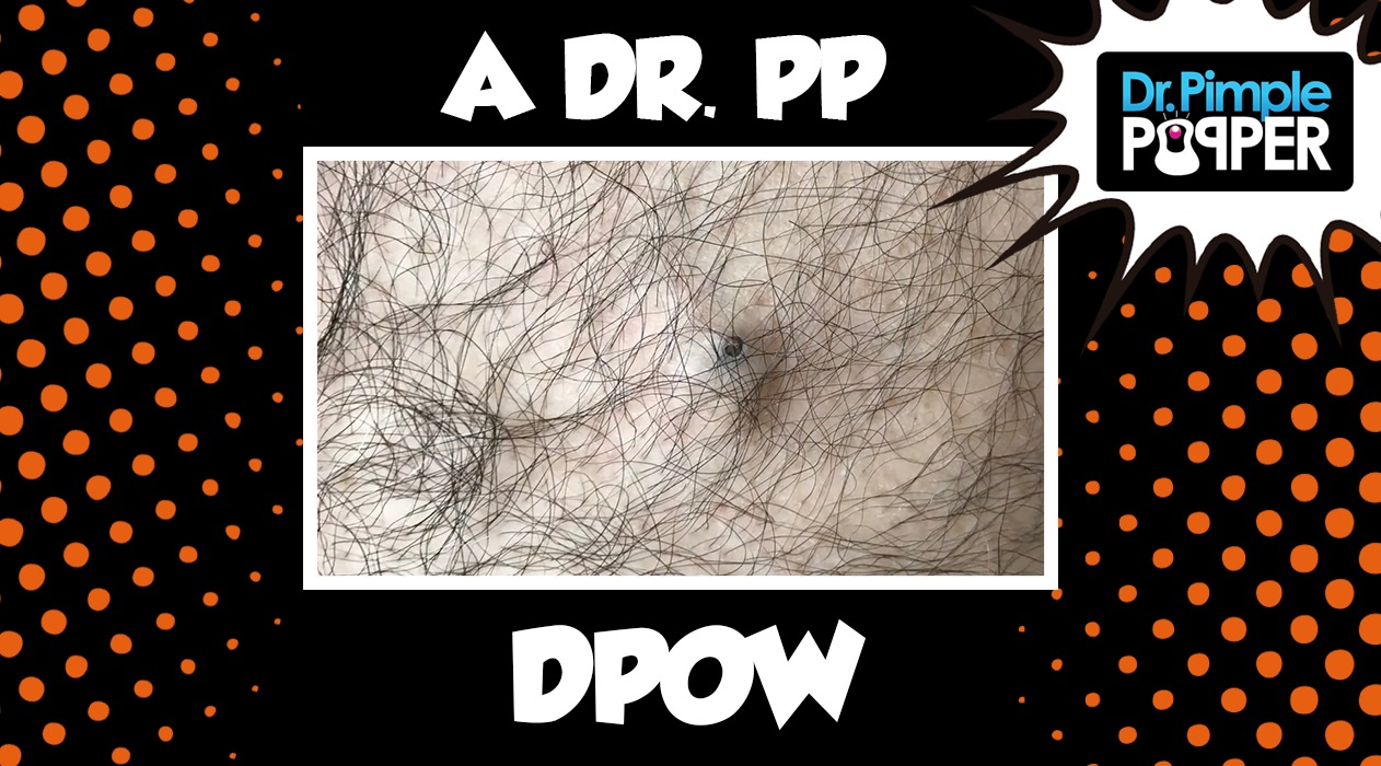 The Jungle Is Dark, but Full of Diamonds... A Dr Pimple Popper DPOW