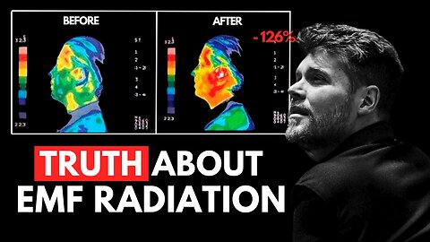 Shane Milson REVEALS: How To NEUTRALIZE The EMF's From Cell Phones, WIFI and Laptops