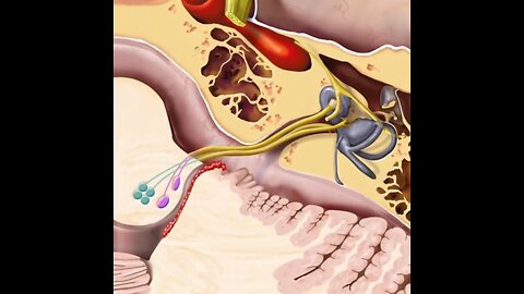 Cranial nerve VIII