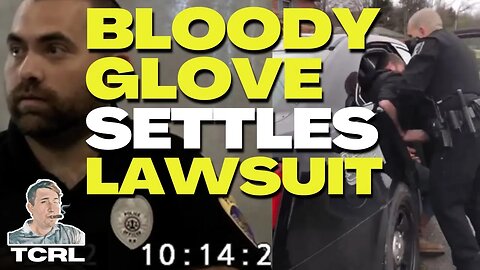 My Client Settles After Bloody Gloves Deposition