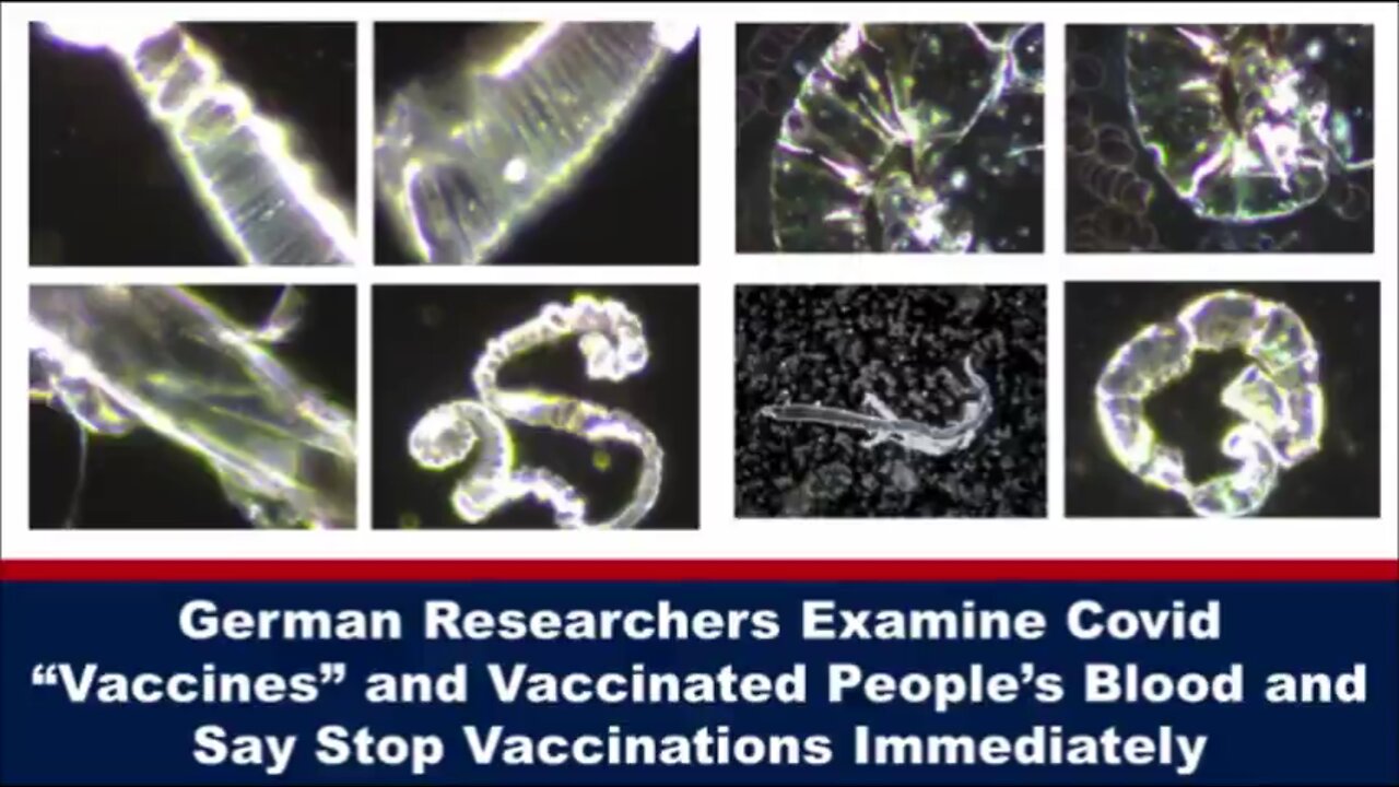 German Researchers Examine Covid Vax And Vaccinated People’S Blood And Say Stop Vaccinations