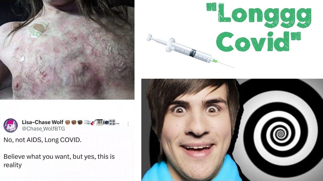 💉😵‍ "Longgg Covid"