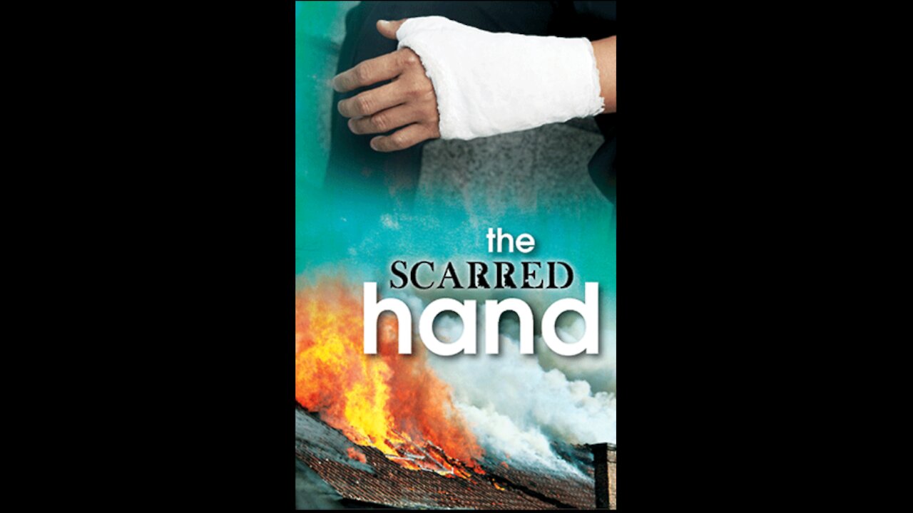 The Scarred Hand