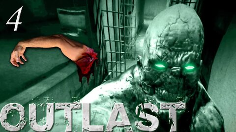 Oh Sure Just TAKE My Favorite Arm! | Outlast - Part 4