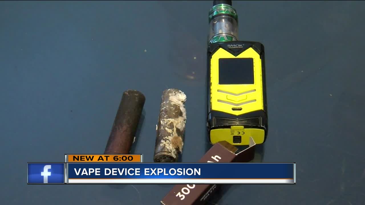 Milwaukee man’s vape explodes in his kitchen