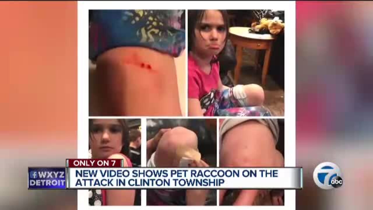 6-year-old girl injured, 8-year-old boy attacked by neighbor's pet raccoon