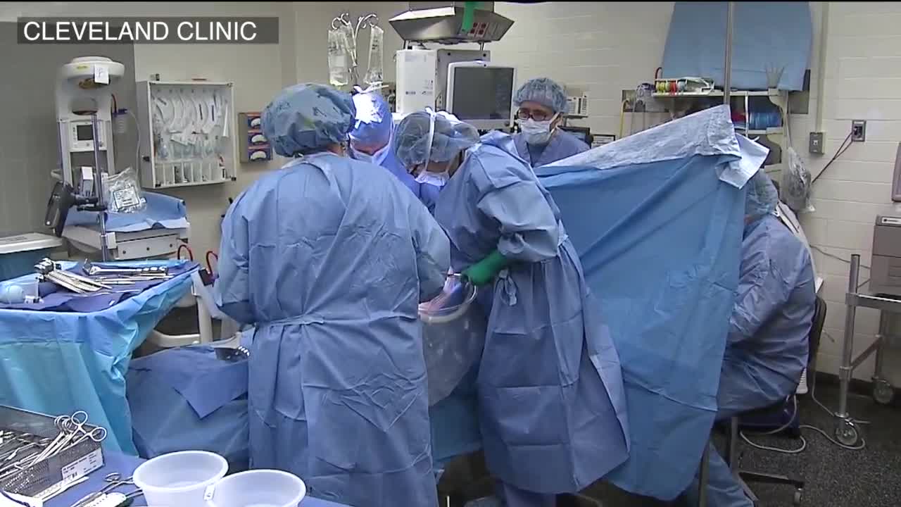 Cleveland Clinic working to reverse rising rates of cesarean sections