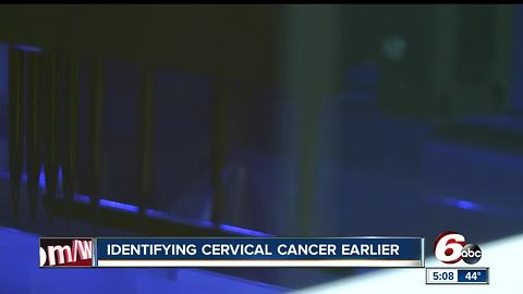 IU Health has new technology to help combat cervical cancer