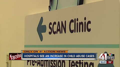 Hospitals see an increase in child abuse cases