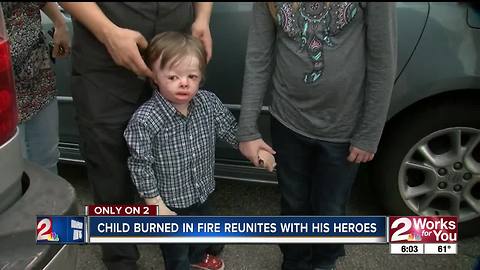 Toddler burned in house fire meets the firefighters who responded nearly one year ago