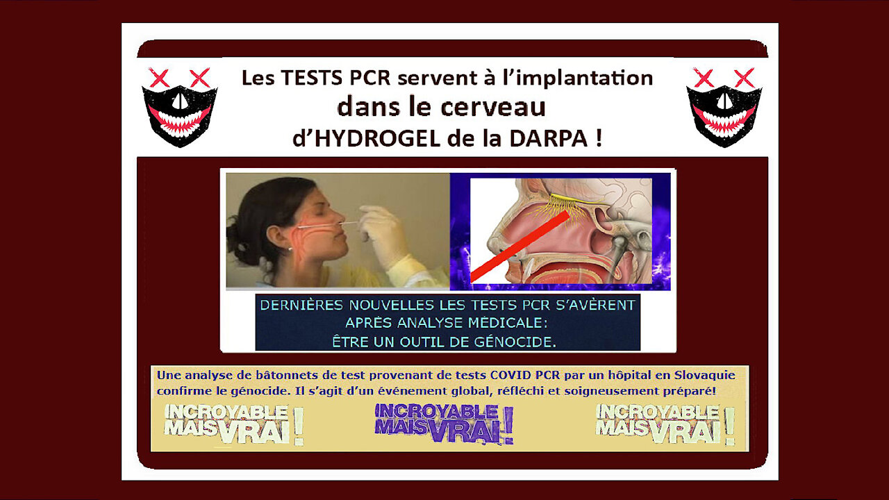 Les "TESTS PCR" servent à l'implantation dans le cerveau d'Hydrogel breveté par la DARPA ! (Hd 1080) Lire descriptif.