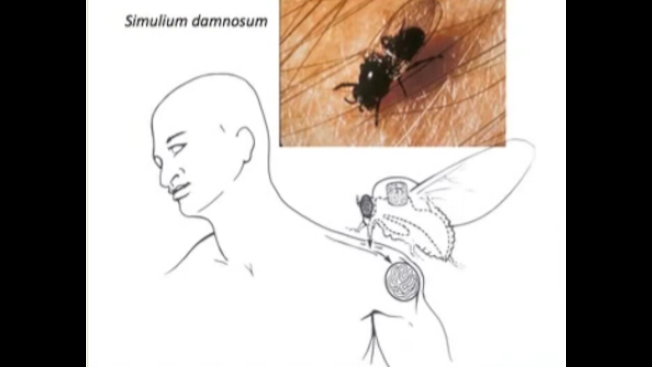The Story of Ivermectin: Professor William Campbell