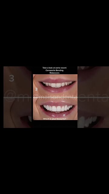 Dental And Teeth Hygiene