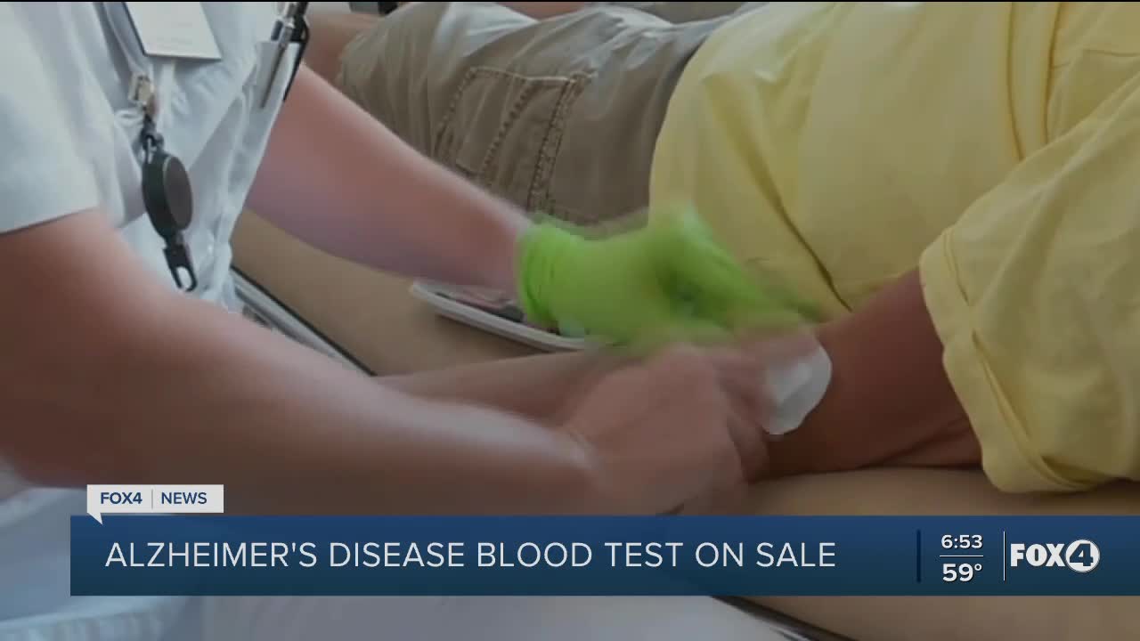 First Alzheimer's blood test on sale