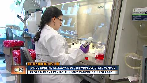 Johns Hopkins researchers are studying how prostate cancer cells spread