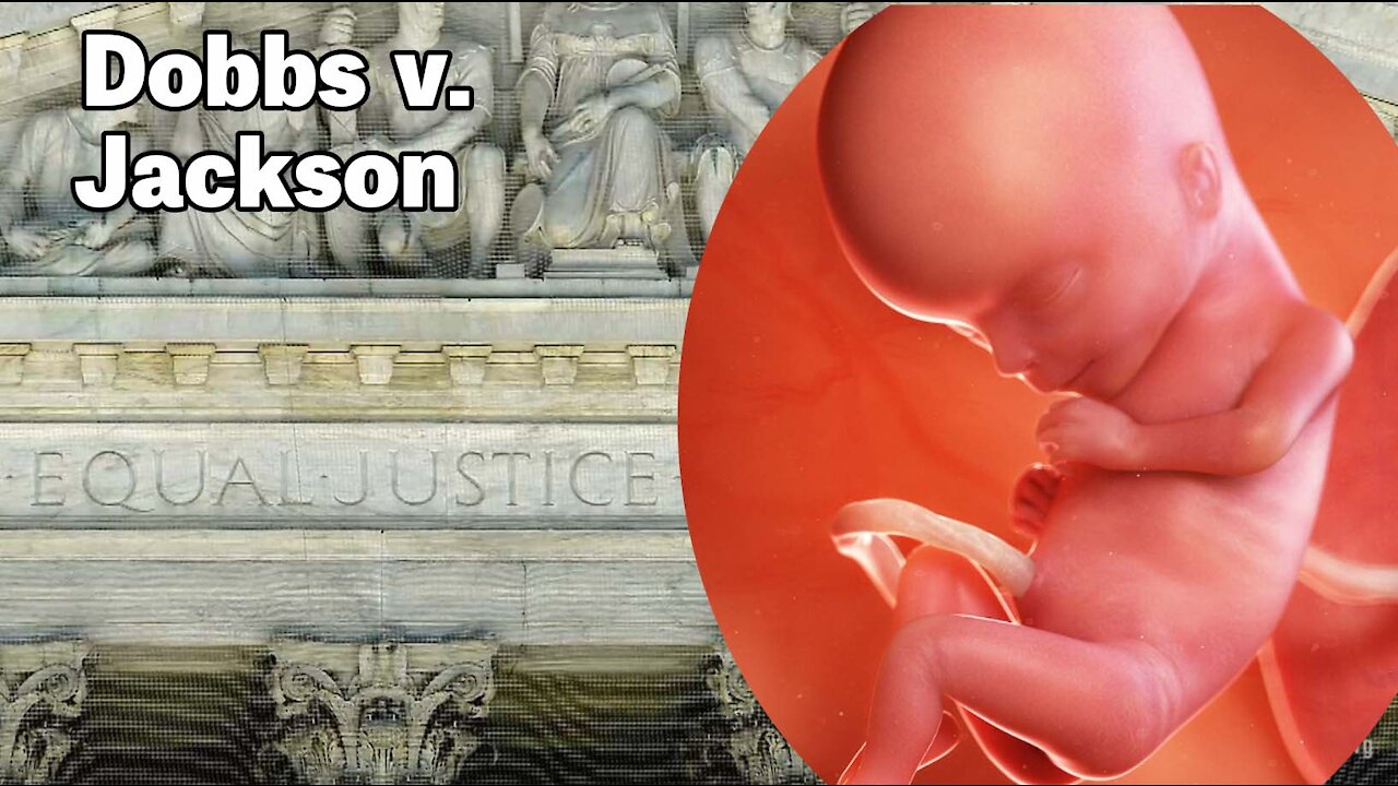 The Supreme Court Must Uphold Abortion Limits