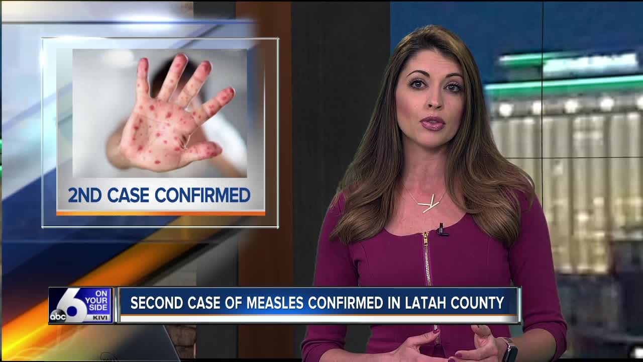 Second measles case confirmed in Idaho