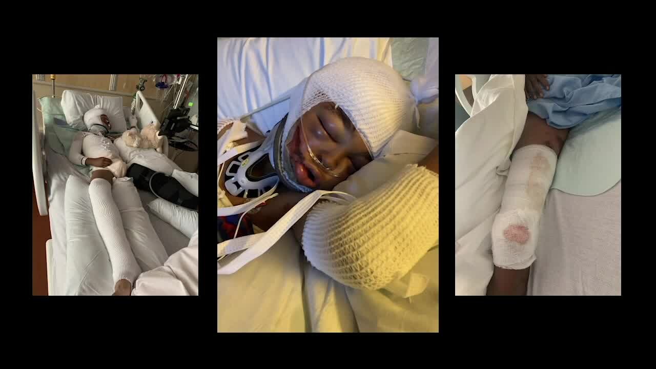 11-year-old has fifth surgery in two weeks after being hit, dragged by SUV while bike riding