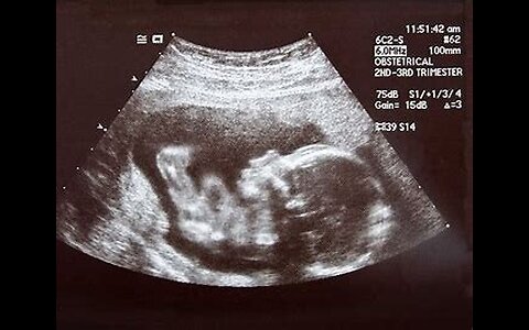 What Babies Do In The Womb
