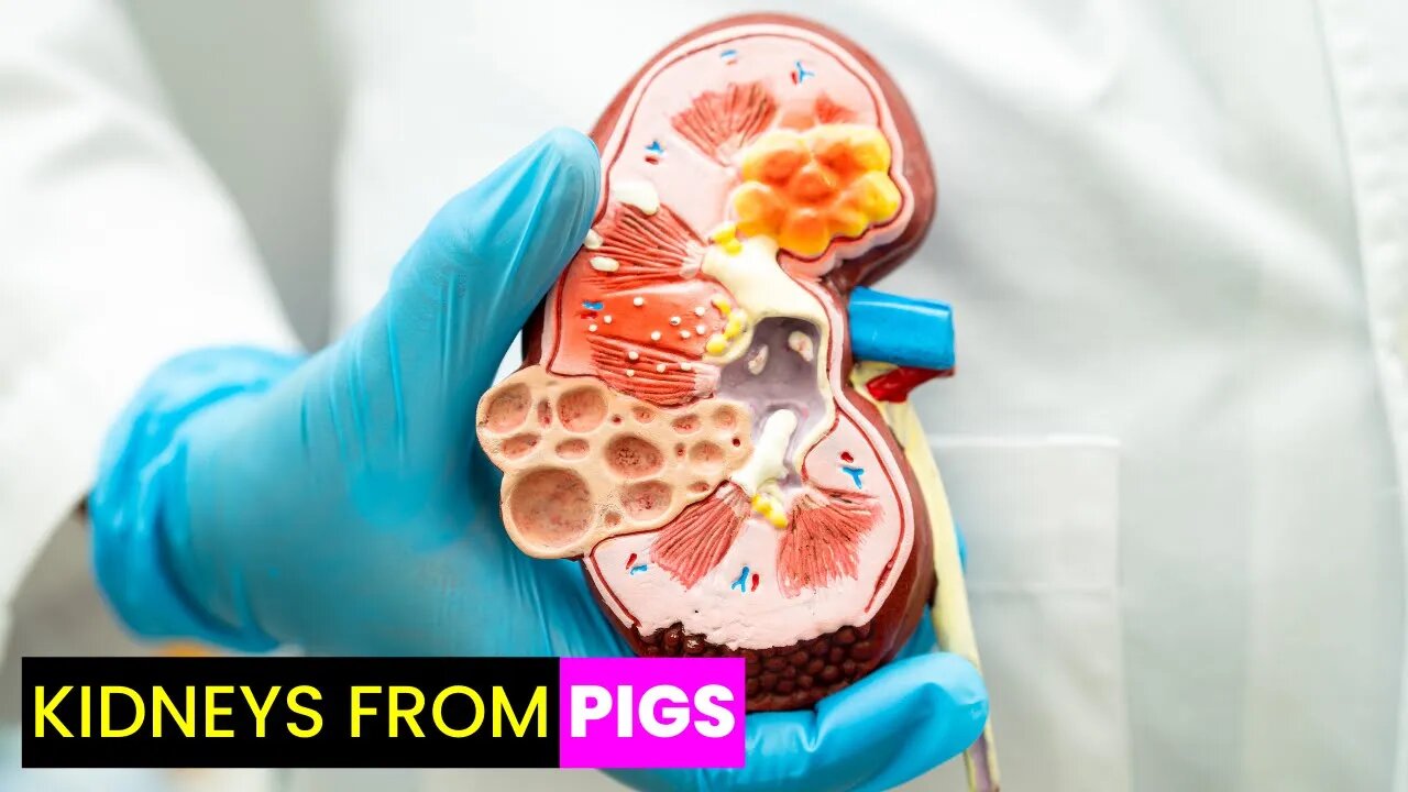 Revolutionary Pig Kidney Transplant: Hope for Kidney Patients | Future Technology & Science News 345