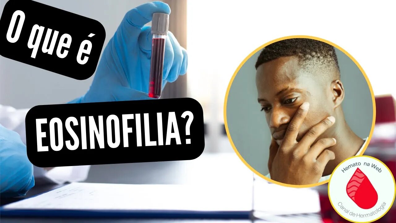 O que são EOSINÓFILOS aumentados [EOSINOFILIA]? GEYDSON CRUZ; MD,MSc